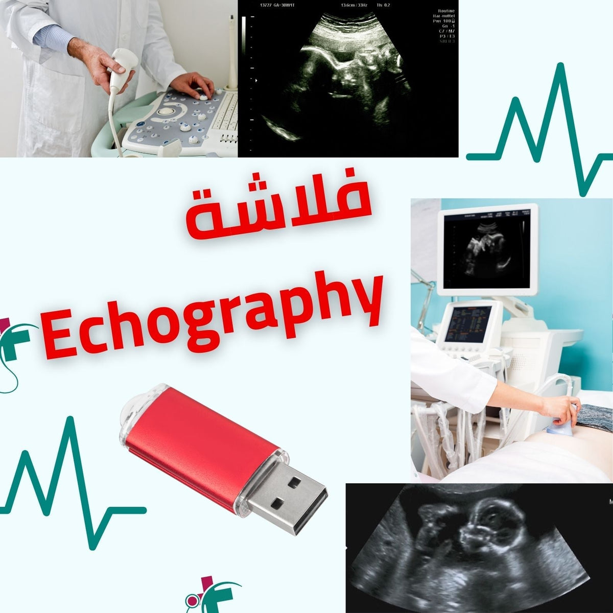 فلاشة الايكوغرافي (الأكثر طلبا)